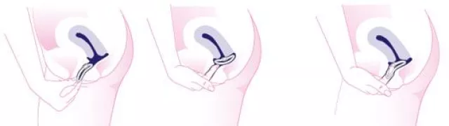 Bild: Weltweit erste Studie zur langfristigen Evaluierung circadianer Temperaturmuster im weiblichen Zyklus