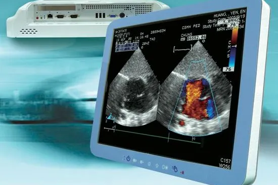 Bild: Medical-Panel-PC als HMI für den Arzt