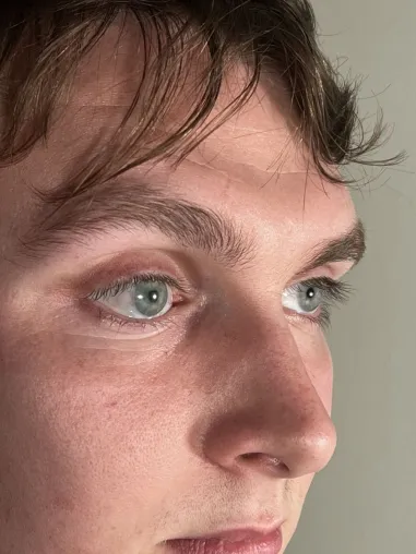 Bild: Durchbruch: Perfektes Computergenerierte Augenprothesen aus dem 3D-Drucker überzeugen in der Praxis