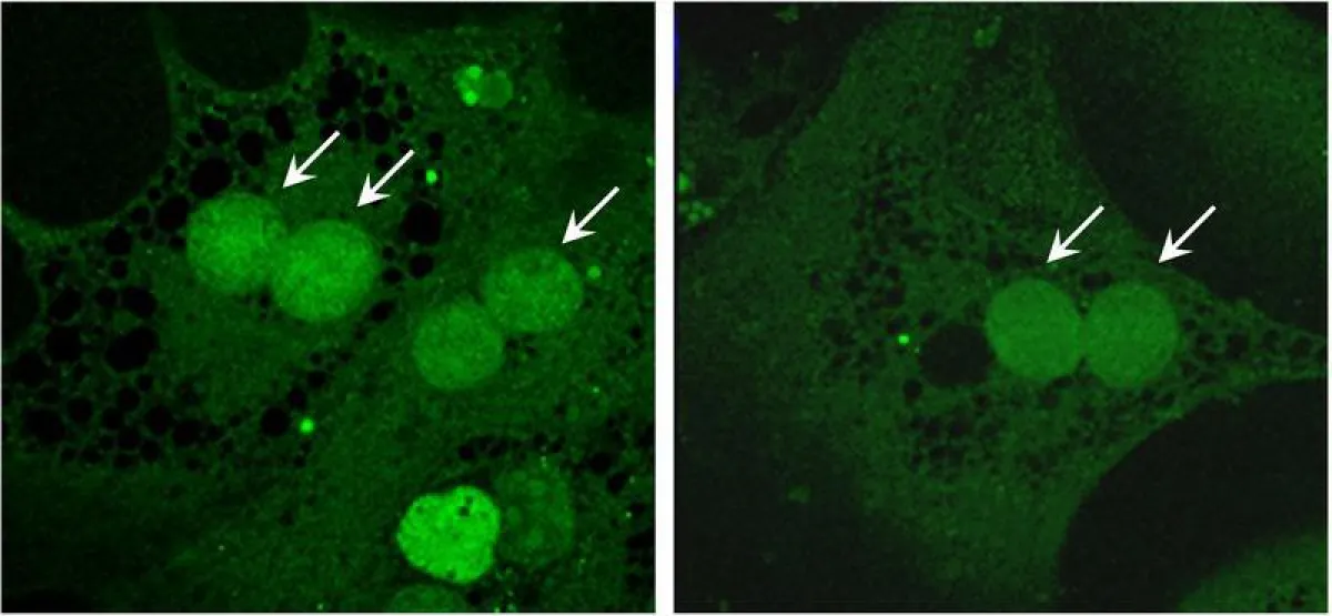 Akkumulation eines Glucosesensors im Zellkern von Leberzellen. Retinol Saturase exprimiert (li) und inhibiert (re). Copyright M. Schupp. ()