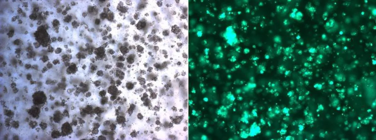 Beispiel von Brustkrebs-Organoiden. Die grünen Zellen in der Fluoreszenzmikroskopie sind genetisch modifiziert, um deren Bedeutung für die Entstehung von Krebsresistenzen zu untersuchen. (© Universitä