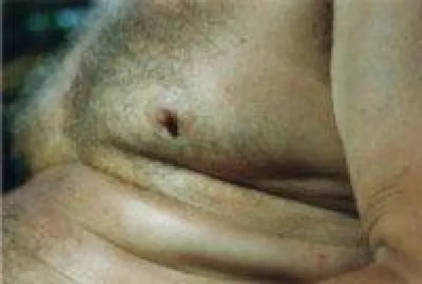 Bild: Deutschland ist zu dick. Und nun - was passiert nach dem IASO Bericht?
