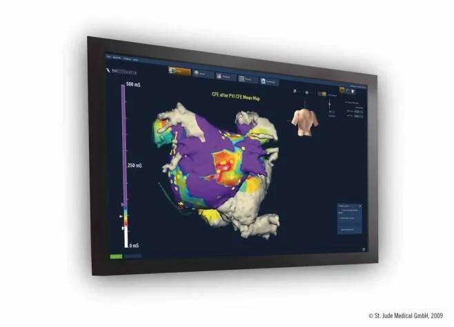 Start der neuen Generation des kardialen Mapping Systems EnSite Velocity™ Bild: Start der neuen Generation des kardialen Mapping Systems EnSite Velocity™