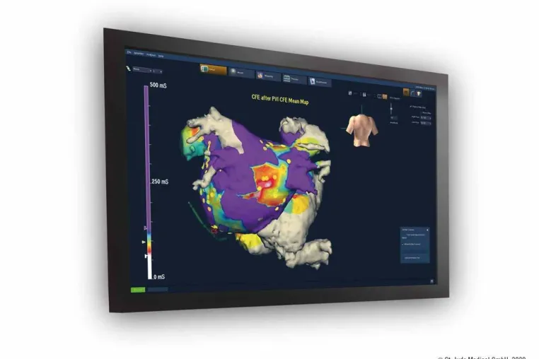 Bild: Start der neuen Generation des kardialen Mapping Systems EnSite Velocity™
