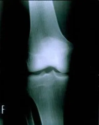 Bild: Zertifizierte Fortbildung zu Rheuma und Osteoporose