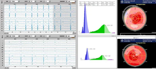 Bild: Stoffwechseltherapie des Herzens