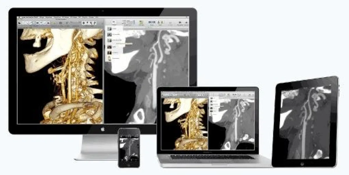 OsiriX PRO für medizinisches Postprocessing