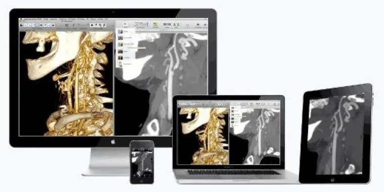 Bild: OsiriX PRO V 2.0 mit neuen Features verfügbar
