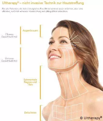 Dr. Prager & Partner: Ultraschalltherapie zur Hautstraffung Bild: Dr. Prager & Partner: Ultraschalltherapie zur Hautstraffung