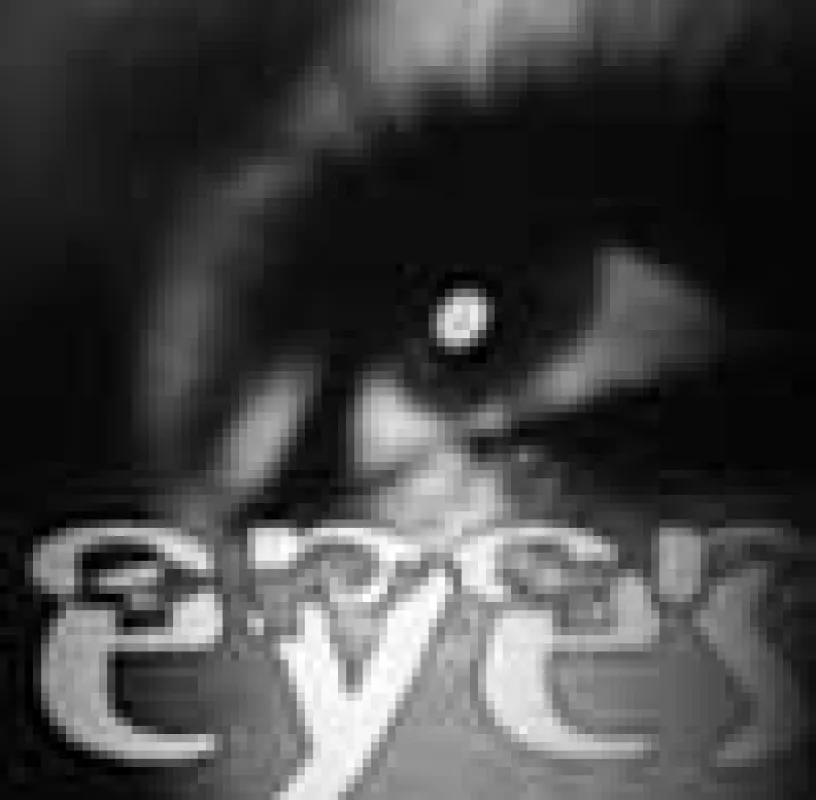 OpenEyes