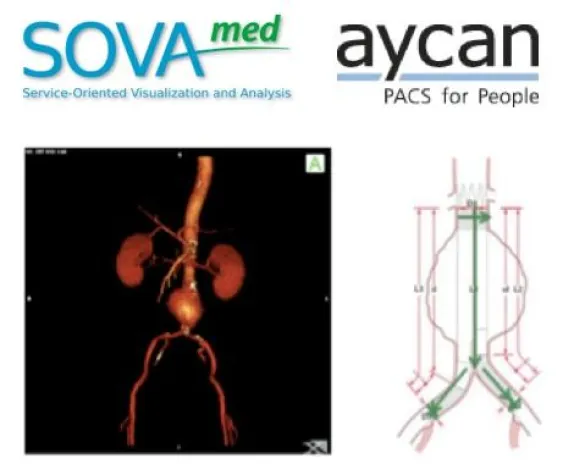 Bild: SOVAmed und aycan geben Partnerschaft bekannt