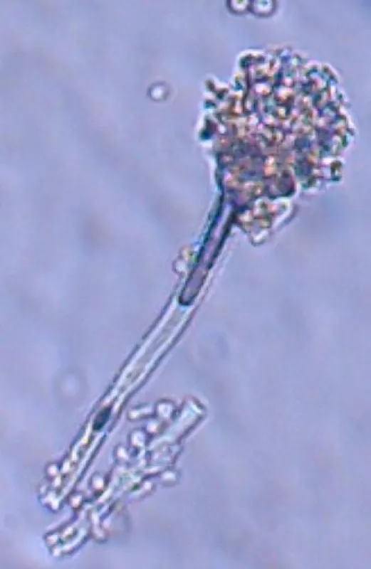 Schimmelpilz (Foto: Bernd Thümmler)