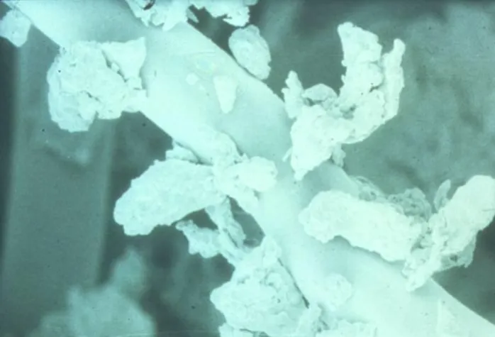 Bild: Hausstauballergie: Jeder 3. Asthmaanfall könnte vermieden werden