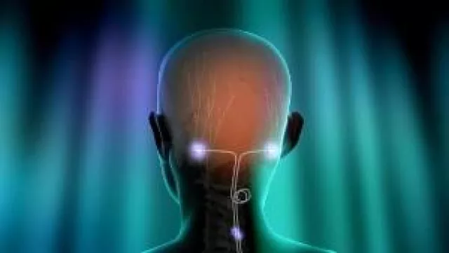 Bild: CE Zeichen für Neurostimulation bei chronischer Migräne