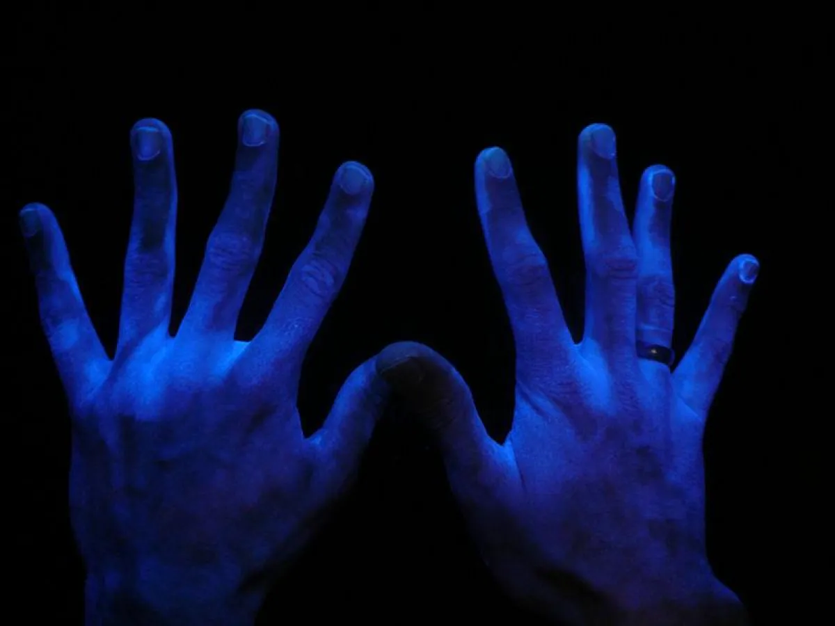 Viele dunkle Stellen an den Händen weisen auf eine unzureichende Desinfektion hin. Die hellen Stelle