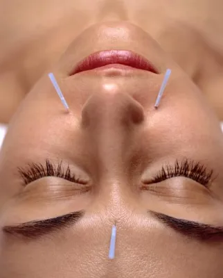 Bild: Hilfe bei Regelschmerzen & Co: Was Akupunktur in der Frauenheilkunde leisten kann