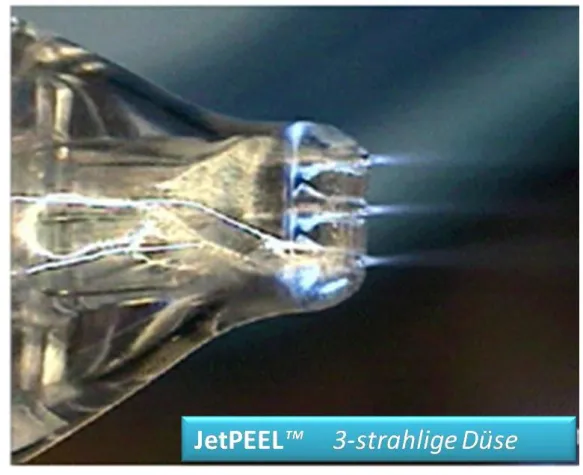 Bild: Innovatives Hautverjüngungssystem mit Überschallgeschwindigkeit