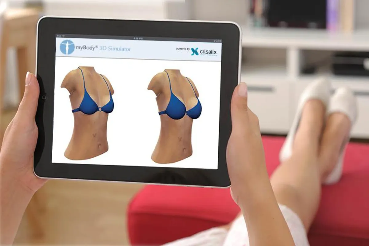 3D Simulation von Schönheitsoperationen