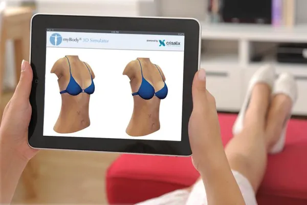 Bild: Vorher-Nachher-Bilder von Schönheits-OPs in 3D