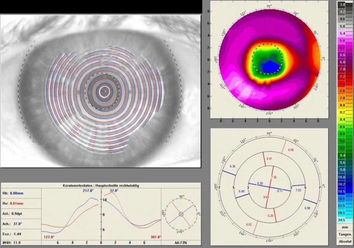 graphische Darstellung versteckter Sehfehler