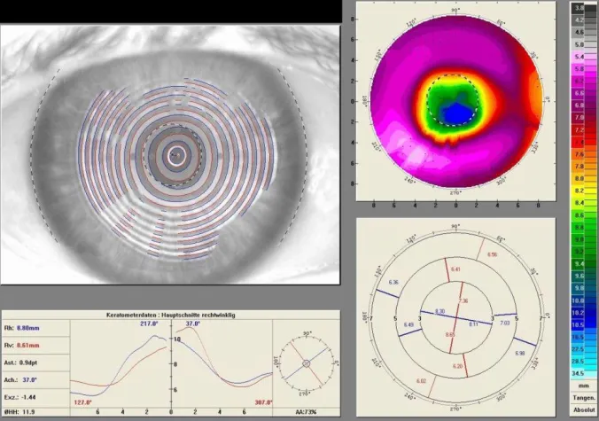 Bild: versteckten Sehfehlern auf der Spur