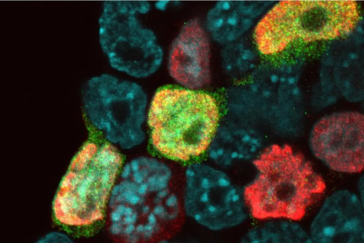 Fluoreszenzbild muriner embryonaler Stammzellen: Zellkerne sind in Blau, 2CLCs in Grün und Zellen im Übergang in Rot dargestellt.  (Quelle: Helmholtz Zentrum München/IES)