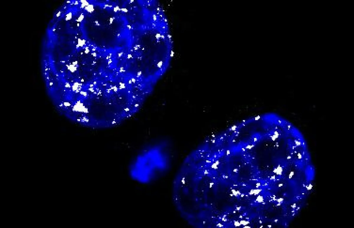 Ein muriner Embryo im zweizelligen Stadium: L1-Transkripte sind weiß, die DNA blau angefärbt. (Quelle: Helmholtz Zentrum München)