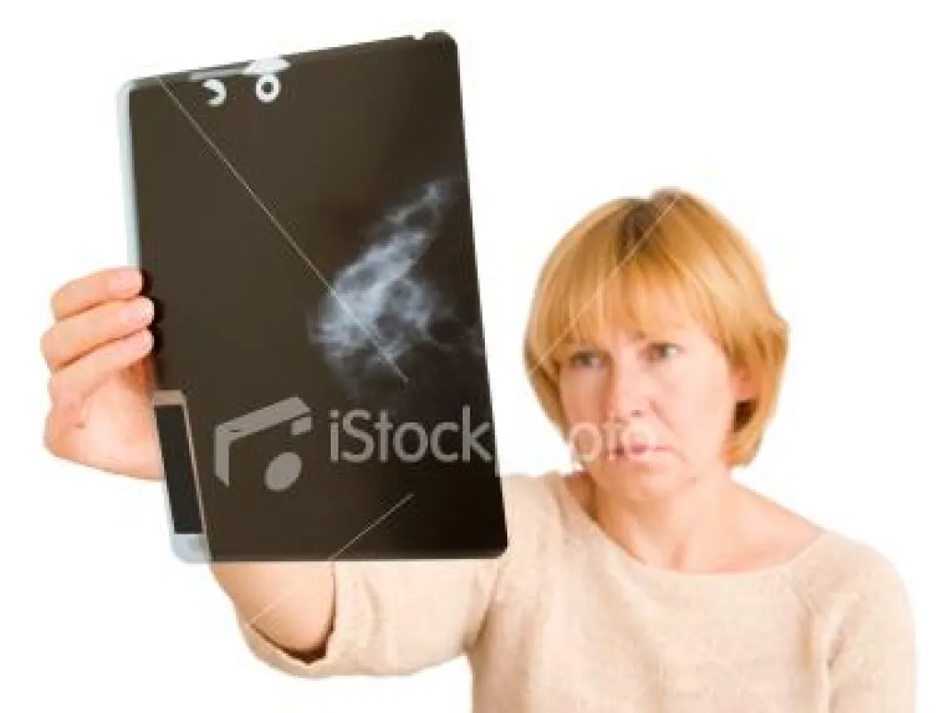 Diagnose Brustkrebs Mamografie