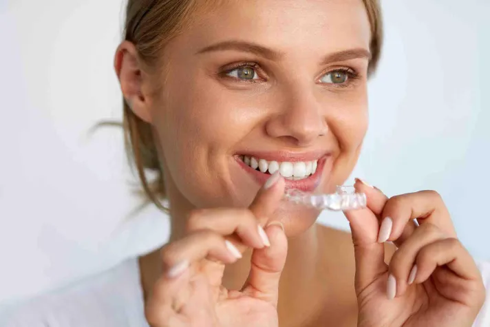 Aligner - die unsichtbare Zahnspange Bild: Aligner - die unsichtbare Zahnspange