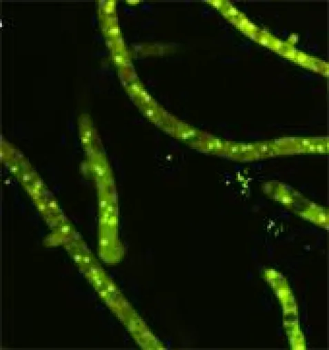 PILZ GEGEN PILZ - FUNGIZIDE AUS DEM "HAUSE PENICILLIUM" Bild: PILZ GEGEN PILZ - FUNGIZIDE AUS DEM "HAUSE PENICILLIUM"