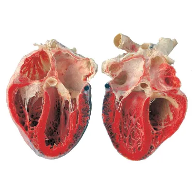 Bild: BEMER & KÖRPERWELTEN – Eine Herzensangelegenheit