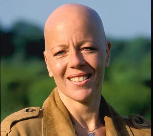 Bild: Haarausfall – Was tun? Intensivseminar in Berlin gibt Antworten