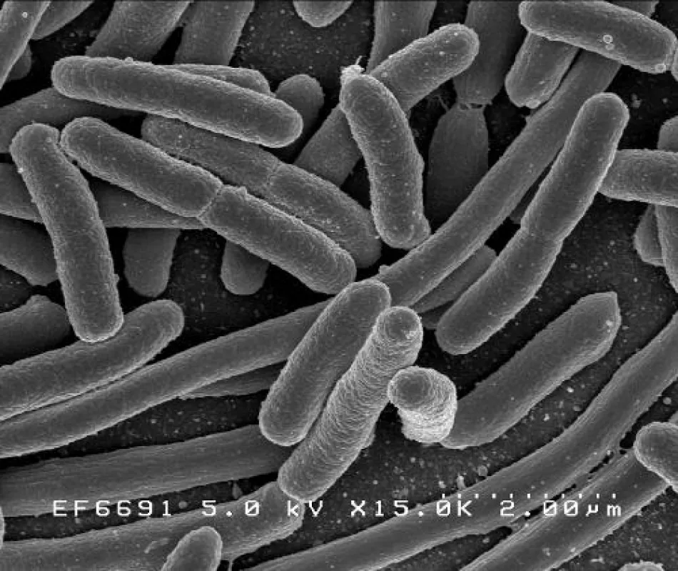 Bakterien unter dem Elektronenmikroskop. Der Durchmesser beträgt 0,6 µm.