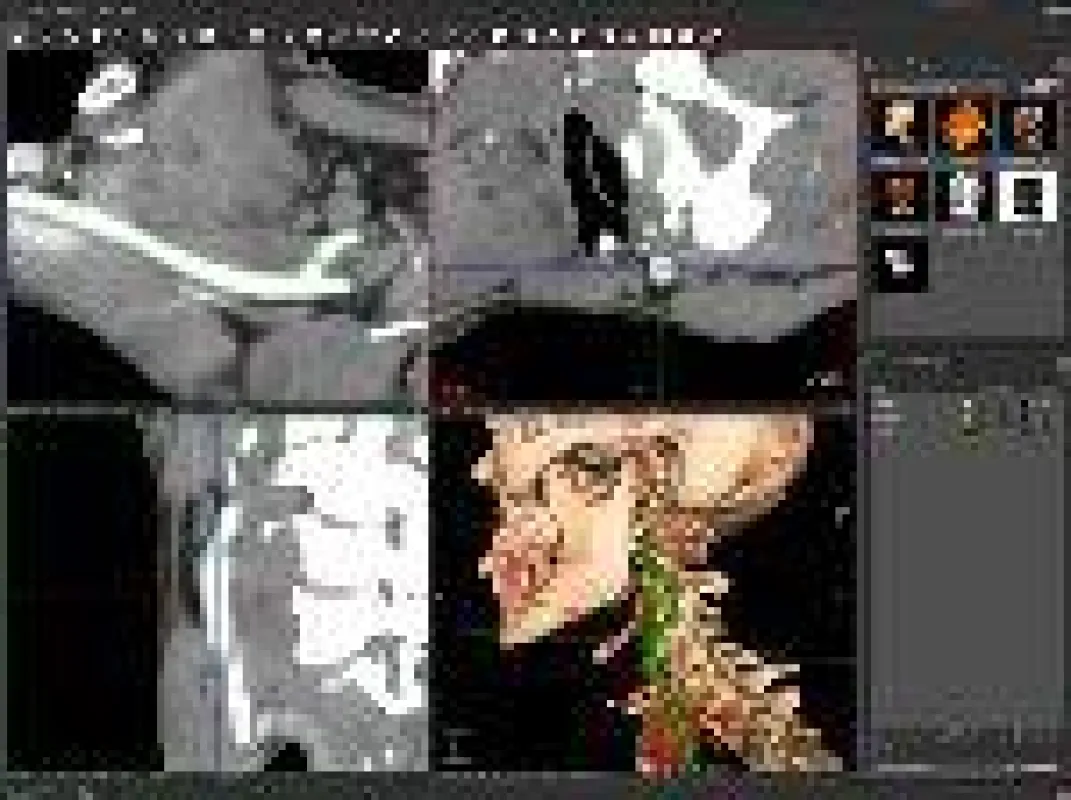 Webbasierte PACS in Thin Clients Technologie erfüllt alle Bedürfnisse der modernen Radiologie in Visualisation und Navigation.