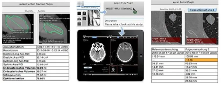 Bild: Plugins für Teleradiologie, Onkologie und Kardiologie für OsiriX PRO