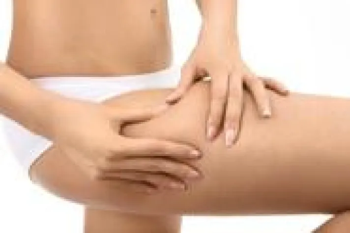 Cellulitis – der Alptraum vieler Frauen. Sport und die richtige Pflege helfen Bild: Cellulitis – der Alptraum vieler Frauen. Sport und die richtige Pflege helfen