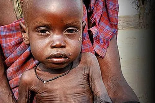 Bild: Hungerkatastrophe in Ostafrika: Hilfe für 80.000 Menschen in kenianischem Flüchtlingslager