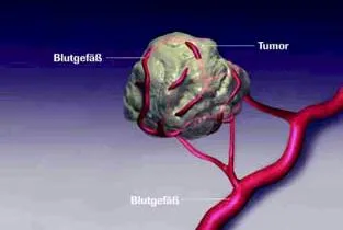 Bild: Nierenkrebs – Aktuelles zur Therapie und Krankheitssituation in Deutschland