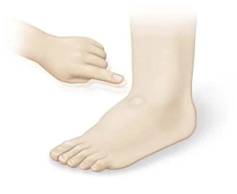 Bild: Klinikeinweisung wegen Herzschwäche: Welche Warnsignale müssen Betroffene kennen?