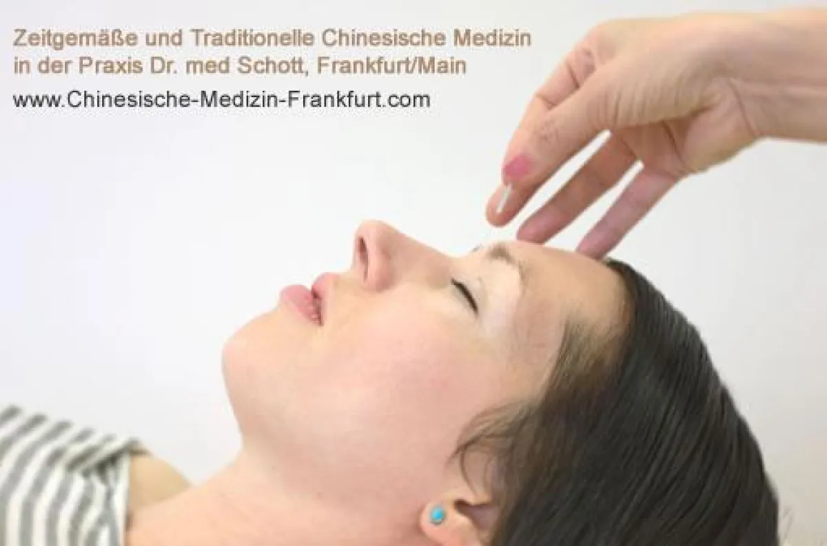 Akupunktur als Schmerztherapie, z.B. bei Kopfschmerz, Migräne, Rückenschmerzen, als Alternative zur Einnahme von Schmerzmitteln.
