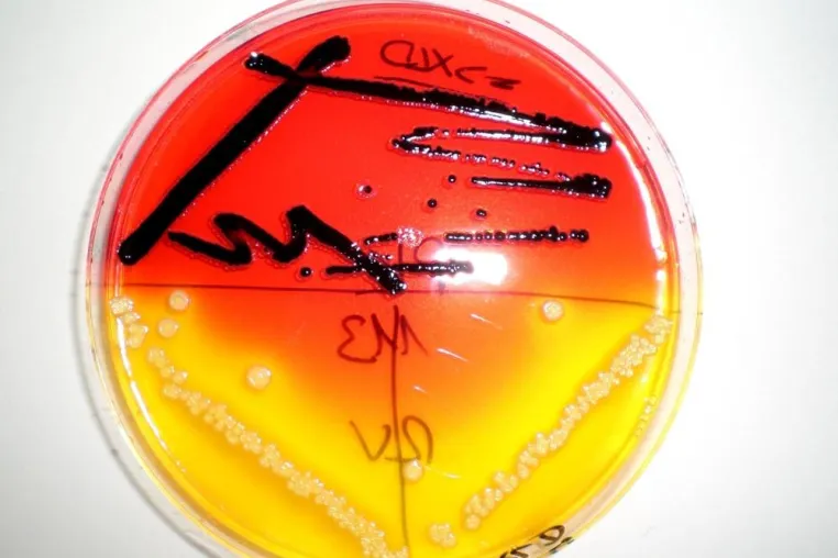 Mikrobiologie für Nicht-Mikrobiologen Bild: Mikrobiologie für Nicht-Mikrobiologen
