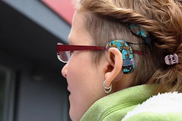 Bild: Taub sein und trotzdem hören können: Zehnter bundesweiter Aktionstag zum Cochlea-Implantat (CI)