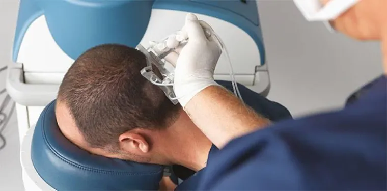 Geheimratsecken adé - mit ARTAS Bild: Geheimratsecken adé - mit ARTAS