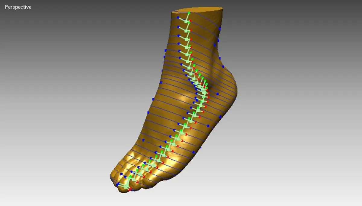 Digitale Präzisionsarbeit: Byosys ermöglicht für die Herstellung von Prothesen den sofortigen Abdruck, Korrektur nach Maß und präzise Formung.