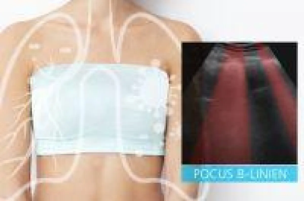 Eine automatisierte Bildanalyse der Point-of-care-Ultraschallaufnahmen unterstützt bei Diagnose und Therapie von Covid19.