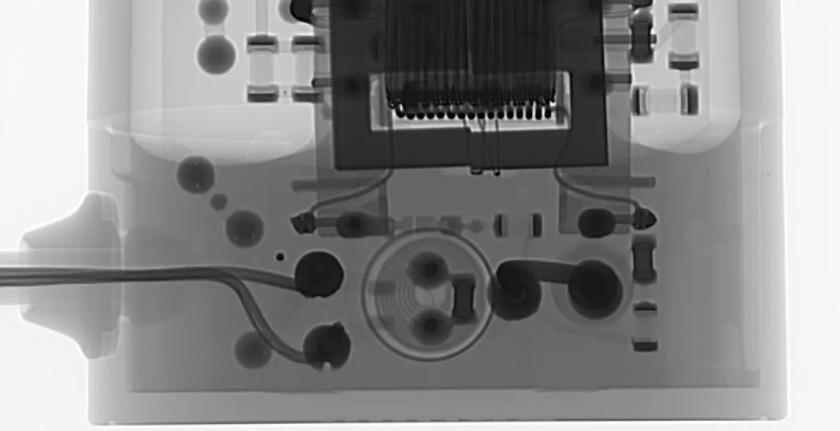 Vergussniveau/ Röntgenaufnahme