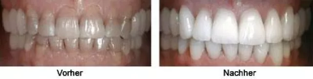 Einfach preiswerte Zahn-Implantate in der Dentaprime-Zahnklinik in Varna: Zahntourismus in Bulgarien Bild: Einfach preiswerte Zahn-Implantate in der Dentaprime-Zahnklinik in Varna: Zahntourismus in Bulgarien