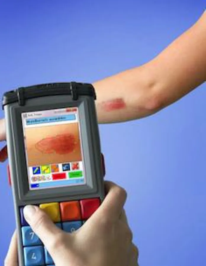 Exakte Wundvermessung und einfache Handhabung - IMAGIS bietet beides.