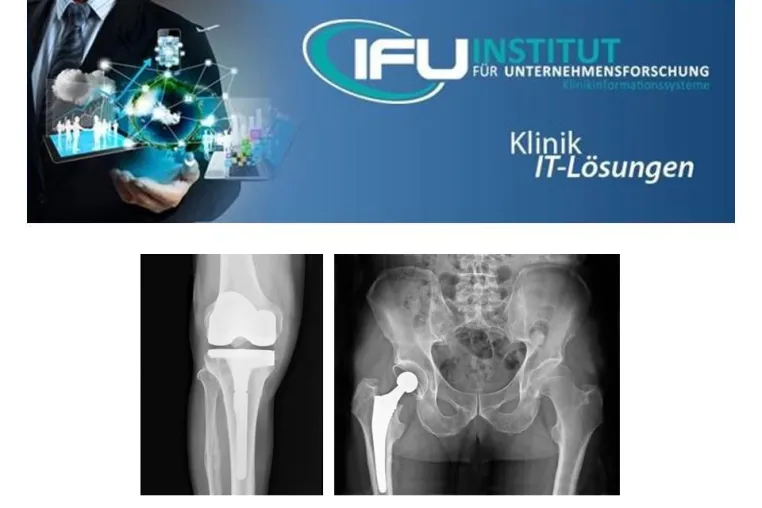 Bild: IFU Software-Erweiterung EndoProthetikZentrum