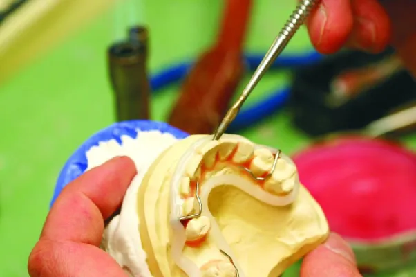 Bild: Entspannter lächeln - Erwachsene leisten sich zunehmend die Korrektur von Zahn- und Kieferfehlstellungen